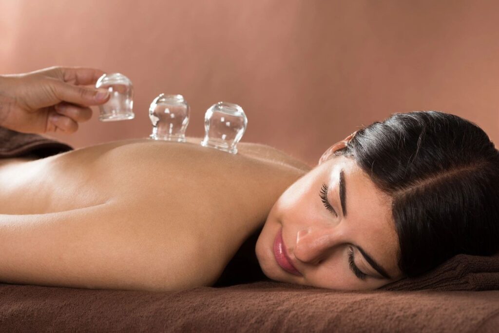 Cupping - Bellesmere Massage and Osteopathic Therapy Clinic